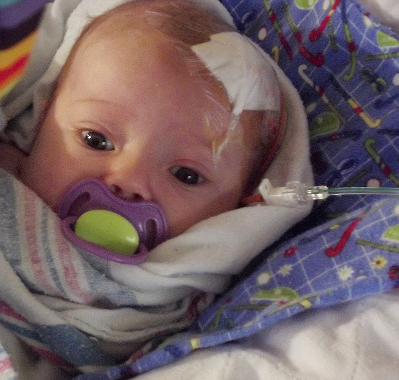 Baby Addison has had four surgeries to remove a cyst and fluid from her brain. Family friends Mike and Kacee Klamm of Auxvasse are hosting a fundraiser April 28 to raise funds to help with her medical bills.