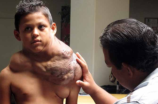 In this July 20, 2012, photo, The father of 9-year-old Juarez-born boy suffering from massive tumor who U.S. Homeland Security identified only as "Jose," examines his shoulder at the First Baptist Church of Rio Rancho, N.M. His family says U.S. federal agents sent in an armored vehicle earlier in the week to their dangerous Juarez neighborhood to help transport the boy and his parents to Albuquerque, N.M. so the boy could receive treatment. 