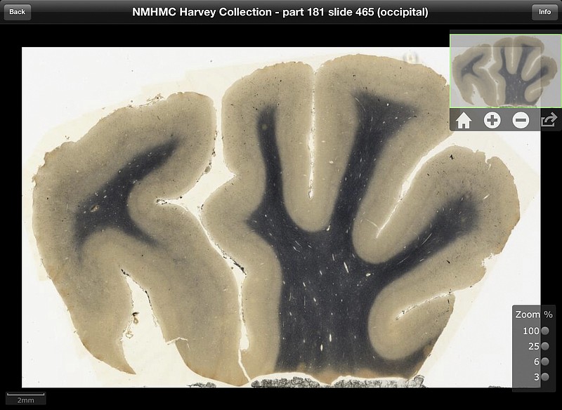 An image of brain tissue is shown from renowned theoretical physicist Albert Einstein. The new application to be released Tuesday will allow users to see Einstein's brain as if they were looking through a microscope. The application promises to make detailed images of his brain more accessible to scientists than ever before.