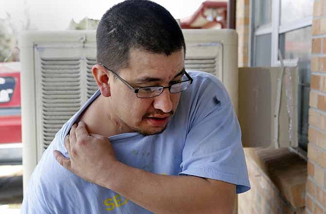 Victor Baca, 29, shows the scar on his cheek and shoulder where he was shot, during an interview at his home on Thursday, March 28, 2013, in Denver. Baca says it was an accidental shooting where Evan Ebel was present. Baca, a close childhood friend of Ebel and cousin to Stevie Vigil, the woman accused of giving Ebel the gun that killed the head of the Colorado Dept. of Corrections, said his cousin is a nursing student who may have bought the gun for protection.