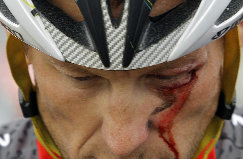 In this May 20, 2010, file photo, Lance Armstrong bleeds from a cut under his left eye after crashing during the fifth stage of the Tour of California.