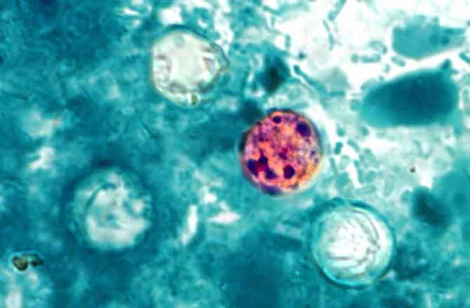 In this image provided by the Centers for Disease Control and Prevention, a photomicrograph of a fresh stool sample, which had been prepared using a 10% formalin solution, and stained with modified acid-fast stain, reveals the presence of four Cyclospora cayetanensis oocysts in the field of view. 