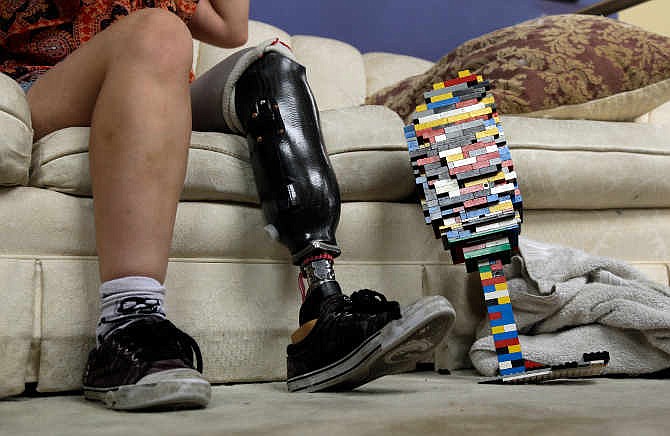 In this photo made July 31, 2013, Christina Stephens sits on a couch wearing her prosthetic leg and next to a prosthetic leg she made out of Legos at her home in St. Louis. After Stephens had her leg amputated below the knee following an accident this past winter, she decided to put her Lego-building skills to work by making a prosthetic leg out of the children's toy and has become an Internet sensation in the process.