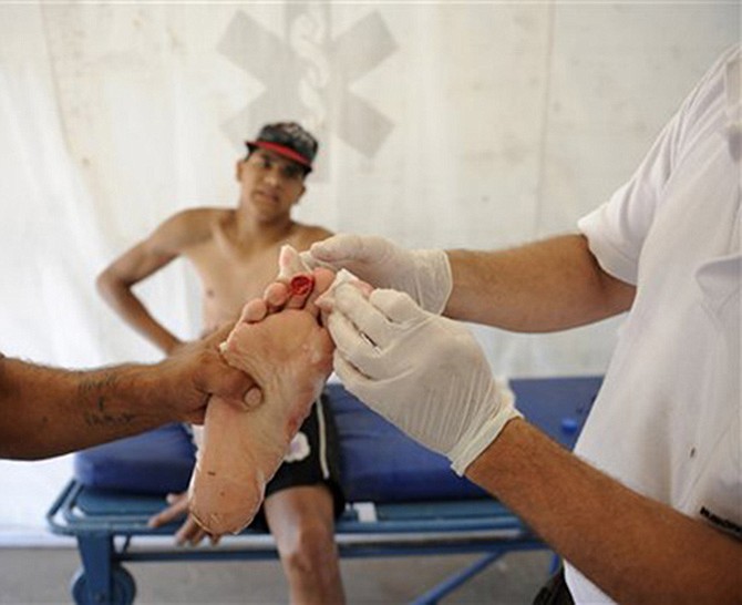 A man is treated after he was bit by a palometa, a type of piranha, while wading in the Pirahna River in Rosario, Argentina.