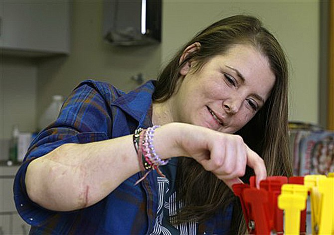 Double hand transplant recipient, Lindsay Aronson Ess, works on her dexterity during a physical therapy session in Richmond, Va. The government is preparing to regulate the new field of hand and face transplants like it does standard organ transplants, giving more Americans who are disabled or disfigured by injury, illness or combat a chance at qualifying for this radical kind of reconstruction.