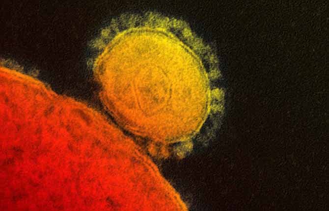 This file photo provided by the National Institute for Allergy and Infectious Diseases shows a colorized transmission of the MERS coronavirus that emerged in 2012.