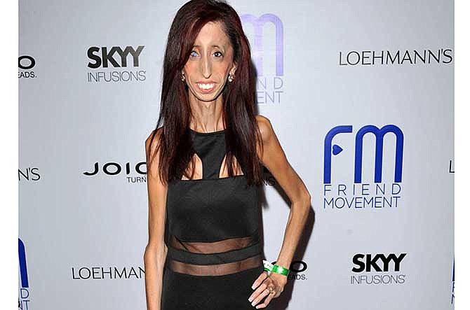 This July 1, 2013 file photo shows author and motivational speaker Lizzie Velasquez at the Friend Movement Anti-Bullying Benefit Concert at the El Rey Theatre in Los Angeles. Velasquez, who possesses a rare and unknown syndrome that prevents her from gaining weight, is raising funds on Kickstarter through June 1, 2014, for an anti-bulling documentary, titled, "The Lizzie Project." 