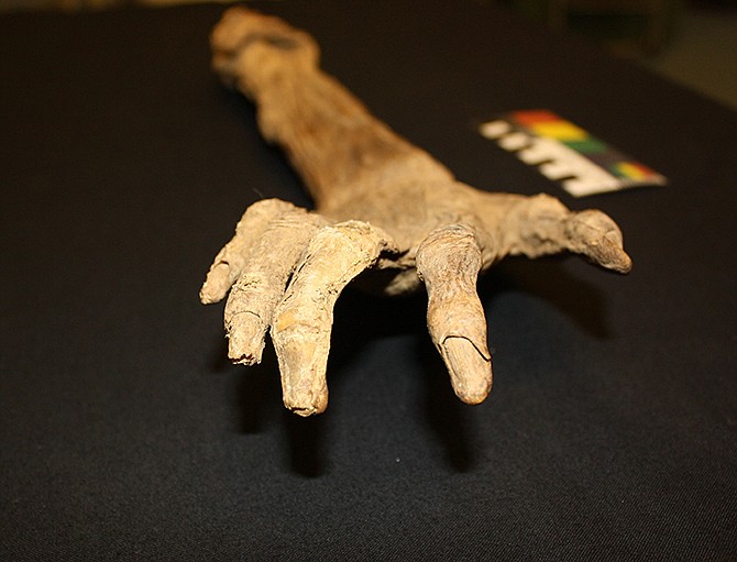 A well-preserved arm purportedly found on the Antietam battlefield near Sharpsburg, Maryland, shortly after the Civil War clash in 1862 is shown in a photograph made at the National Museum of Civil War Medicine in Frederick, Maryland. 