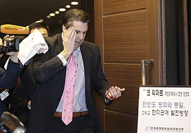 U.S. Ambassador to South Korea Mark Lippert placing his right hand on his face leaves a lecture hall for a hospital in Seoul, South Korea, Thursday, after being attacked by a man.