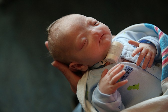 Brandi McGlathery tends to her son Eli at the NICU at USA Children's and Women's Hospital in Mobile, Alabama, on March 19. Eli was born at South Baldwin Hospital on March 4 without a nose. 
