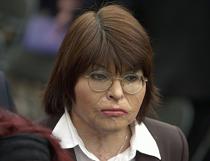 Chilean Carmen Gloria Quintana attends a 2003 ceremony marking the 30th anniversary of the Sept. 11 military coup lead by Gen. Augusto Pinochet at the government palace La Moneda, in Santiago, Chile. 