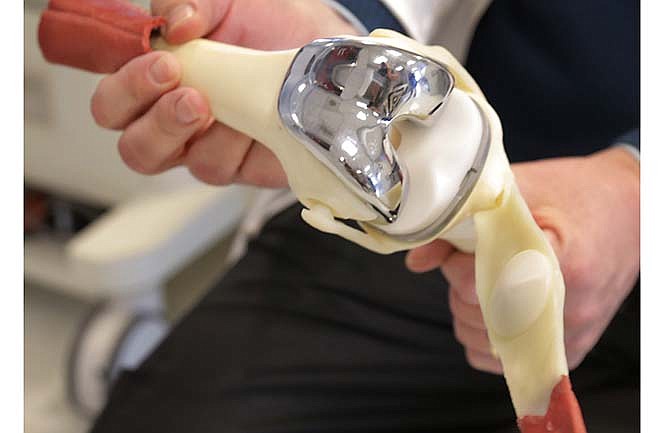 In this Wednesday, March 5, 2014 file photo, a doctor holds a model of a tri-compartmental total knee replacement in Chicago. In a commentary by published by the New England Journal of Medicine on Wednesday, Oct. 21, 2015, Dr. Jeffrey Katz, a joint specialist at Brigham and Women's Hospital in Boston, says people with knees worn out by arthritis will get more pain relief from joint replacement surgery, but it has more risks and there's a good chance that less drastic approaches also would help. That's the bottom line from the first study to strictly test other treatments against knee replacement, an operation done hundreds of thousands of times a year in the U.S. 