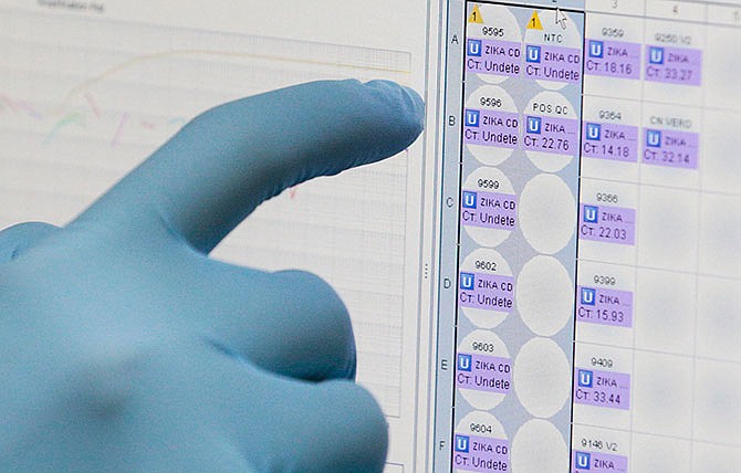 In this Thursday, Feb. 4, 2016, file photo, a medical researcher uses a monitor that shows the results of blood tests for various diseases, including Zika, at the Gorgas Memorial laboratory in Panama City.