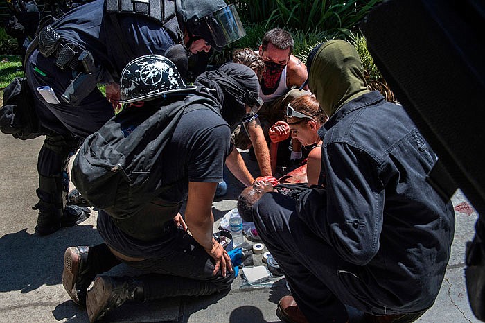 A victim is attended to after he was stabbed during a rally at the State Capitol in Sacramento, California, on Sunday. Sacramento Fire Department spokesman Chris Harvey said a rally by KKK and other right-wing extremists groups turned violent Sunday when they were met by counterprotesters.