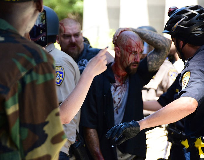 Police escort wounded man away from in front of the Capitol in Scramento on Sunday after members of right-wing extremists groups holding a rally outside the California state Capitol building clashed with counter-protesters. 