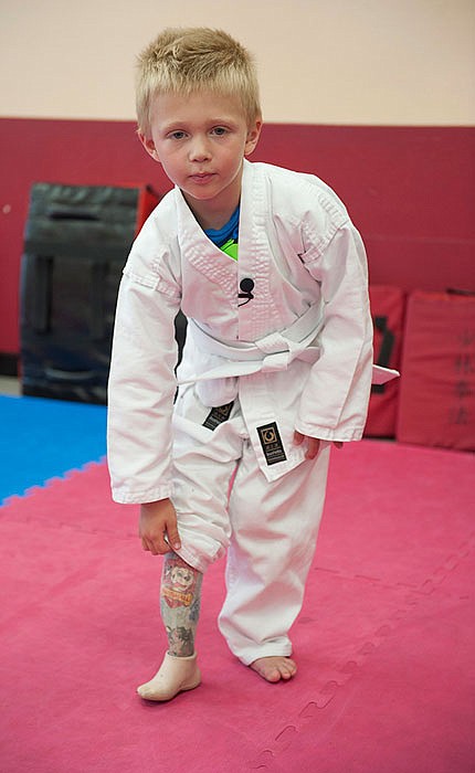 Liam Brenes, 4, of Rancho Santa Margarita, shows the prosthetic leg he is forced to use during karate practice in Mission Viejo, California.