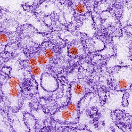 This 2016 digitally-colorized electron microscope image made available by the Centers for Disease Control and Prevention shows the Zika virus, in red, about 40 nanometers in diameter. 