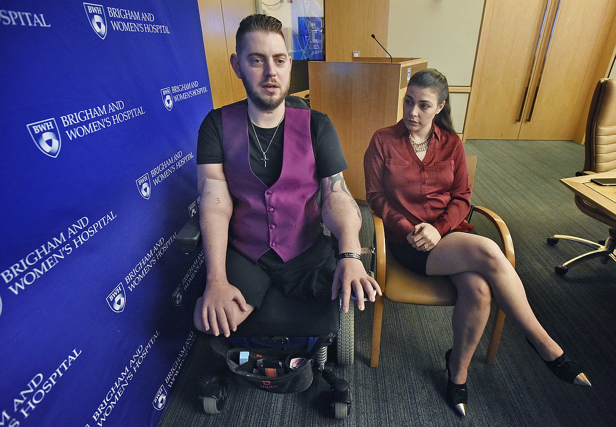 Recipient of double arm transplant says he can now hold his fianceé's hand