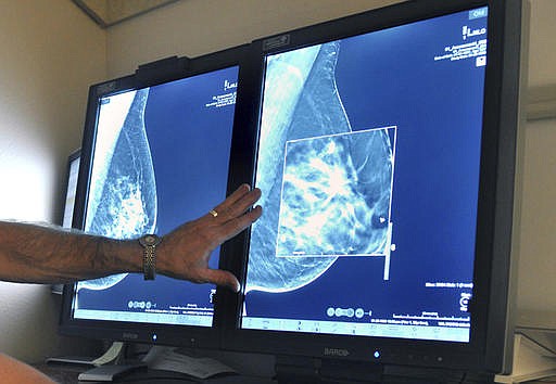 In this Tuesday, July 31, 2012 file photo, a radiologist compares an image from earlier, 2-D technology mammogram to the new 3-D Digital Breast Tomosynthesis mammography in Wichita Falls, Texas. The technology can detect much smaller cancers earlier. A study released Wednesday, Oct. 12, 2016 questions the value of mammograms for breast cancer screening. It concludes that a woman is more likely to be diagnosed with a tumor that is not destined to become large, and presumably more life-threatening, than she is to have earlier detection of one that is. (Torin Halsey/Times Record News via AP)