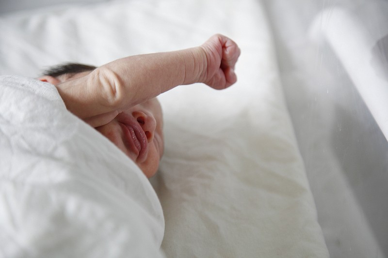 In this July 26, 2016 file photo, a newborn baby with microcephaly rests at a maternity ward of the University Hospital in Tegucigalpa, Honduras. Researchers say the severe birth defect caused by Zika infection may not be apparent at birth but develop months afterward, further confirmation that the virus can cause unseen damage to developing babies.