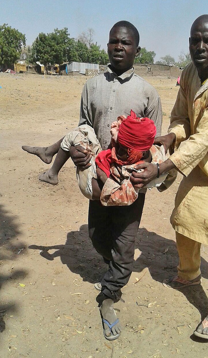 In this image supplied by MSF, a man carries an injured child following a military air strike at a camp for displaced people in Rann, Nigeria, Tuesday Jan. 17, 2017.  Relief volunteers are believed to be among the more than 100 dead after a Nigerian Air Force jet fighter mistakenly bombed the refugee camp, while on a mission against Boko Haram extremists. Medical condition of the child unknown.