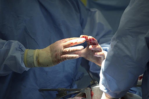 In this Tuesday, June 28, 2016 file photo, surgeons discuss a procedure during a surgery in Washington. In a study released Wednesday, Feb. 15, 2017, complications including infections and surgical incision problems were most common in patients whose surgeons had received lots of earlier complaints about their behavior. 