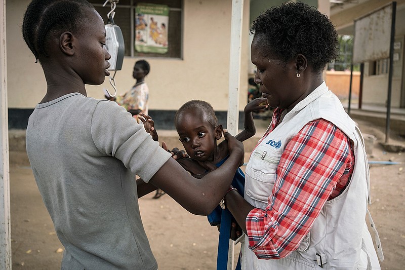 In this photo taken Tuesday, March 14, 2017, a mother, left, takes hold of her son after he was weighed and found to be suffering from severe acute malnutrition, at Al Sabbah Children's Hospital in Juba, South Sudan. The world's largest humanitarian crisis in 70 years has been declared in three African countries on the brink of famine, just as President Donald Trump's proposed foreign aid cuts threaten to pull the United States back from its historic role as the world's top emergency donor. 