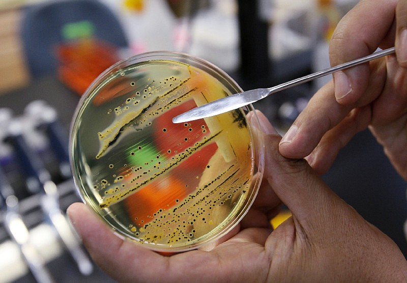 In this Monday, May 17, 2010 file photo, Dr. Mansour Samadpour points out a growth of of salmonella in a petri dish at IEH Laboratories in Lake Forest Park, Wash. 