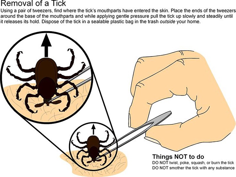 This graphic explains how to properly remove a tick.