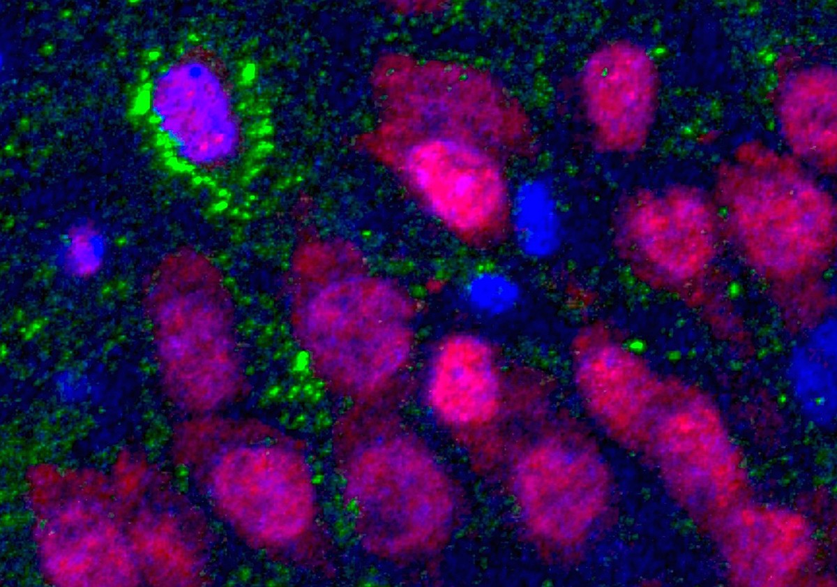 Scientists find signs of new brain cells in adults as old as 79 ...