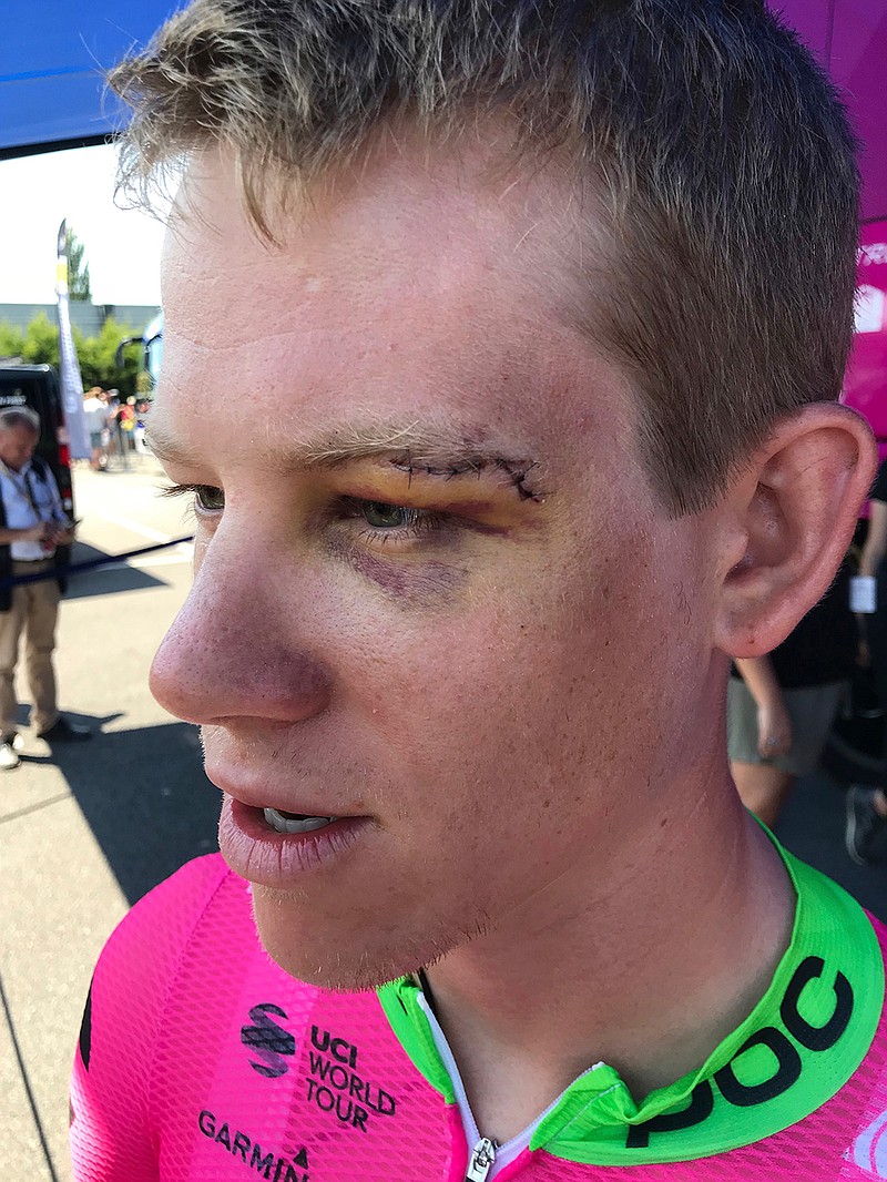 In this July 10, 2018 image, Lawson Craddock of the U.S. talks to reporters in La Baule, France, prior to the start of the fourth stage of the Tour de France cycling race. After breaking his shoulder and bloodying his face in an unfortunate crash during the first stage of the Tour de France, American rider Lawson Craddock has soldiered through six more grueling days of the world's biggest bike race. (AP Photo/Andrew Dampf)