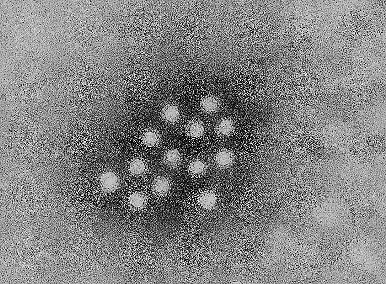 Hepatitis A virus