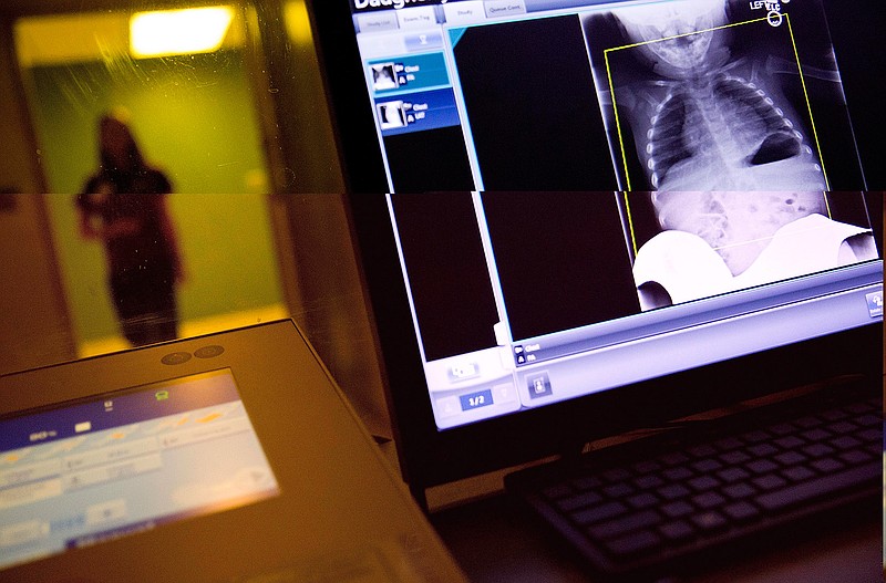 In this Feb. 9, 2018, file photo, a radiology technician looks at a chest X-ray of a child suffering from flu symptoms at Upson Regional Medical Center in Thomaston, Ga.  The Trump administration is quietly trying to weaken radiation rules, relying on scientific outliers who argue that a little radiation damage is actually good for you -- like a little bit of sunlight.  (AP Photo/David Goldman, File)