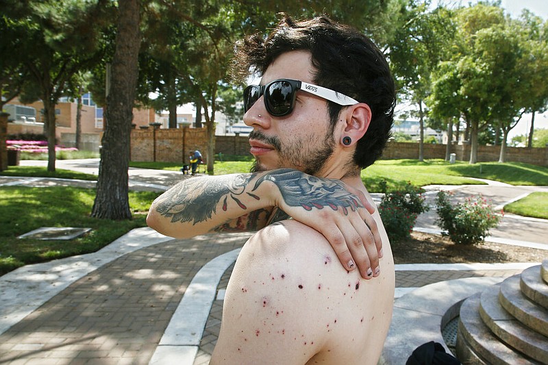 Daniel Munoz reaches for his injured back during an interview, Sunday, Sept. 1, 2019, in Odessa, Texas. Munoz was injured in Saturday's shooting. The tattoo on his right hand is a biblical reference, that the wages of sin are death and God's gift is everlasting life. (AP Photo/Sue Ogrocki)