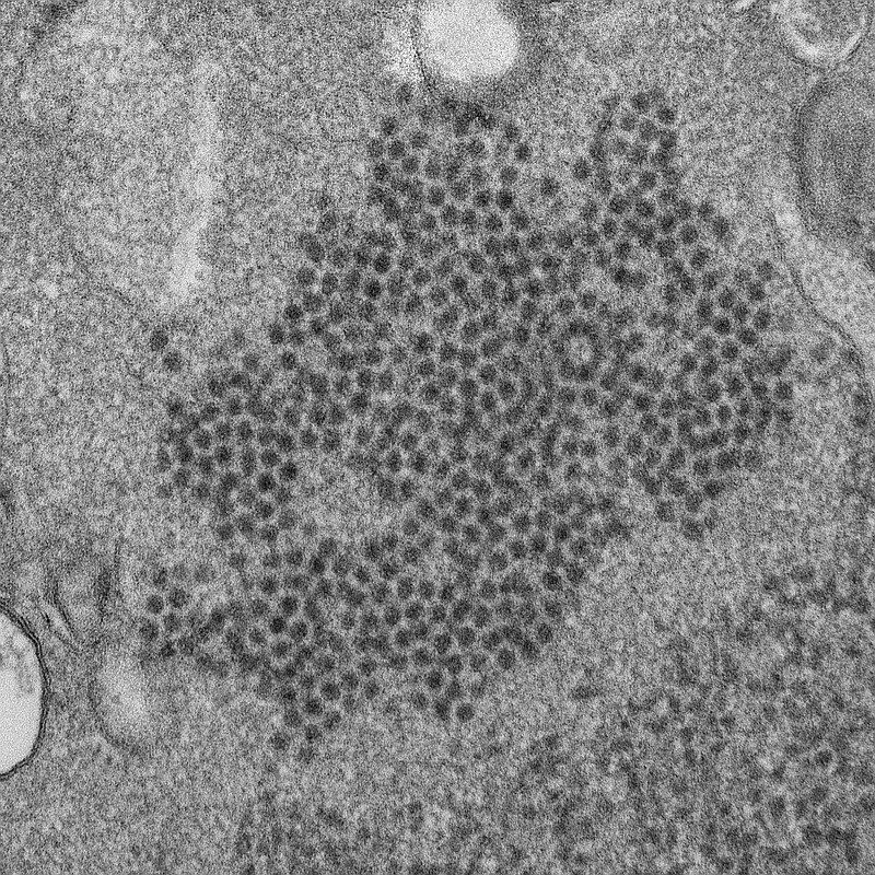 FILE - This 2014 file electron microscope image made available by the Centers for Disease Control and Prevention shows numerous, spheroid-shaped enterovirus-D68 (EV-D68) virions. Scientists have found the strongest evidence yet that a virus is to blame for a mysterious and rare illness, called acute flaccid myelitis or AFM, that can start like the sniffles but quickly paralyze children. University of California, San Francisco, researchers tested how the immune system fought back and found clear signs that an enterovirus, a common seasonal virus that specialists have suspected, was indeed the culprit. The the Centers for Disease Control and Prevention noted that AFM spikes coincided with seasons when certain strains of enteroviruses - EV-D68 and EV-A71 - were causing widespread respiratory illnesses.  (Cynthia S. Goldsmith, Yiting Zhang/CDC via AP, File)