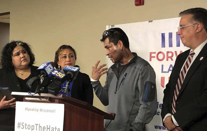 Mahud Villalaz, 42, of Milwaukee gestures to the second-degree burns on his face Saturday November 2, 2019 at a news conference one day after a man threw acid at him outside a restaurant on Milwaukee's south side. He is joined by, from left, state Rep. JoCasta Zamarripa, his sister, and Forward Latino leader Darryl Morin. (Sophie Carson/Milwaukee Journal-Sentinel via AP)