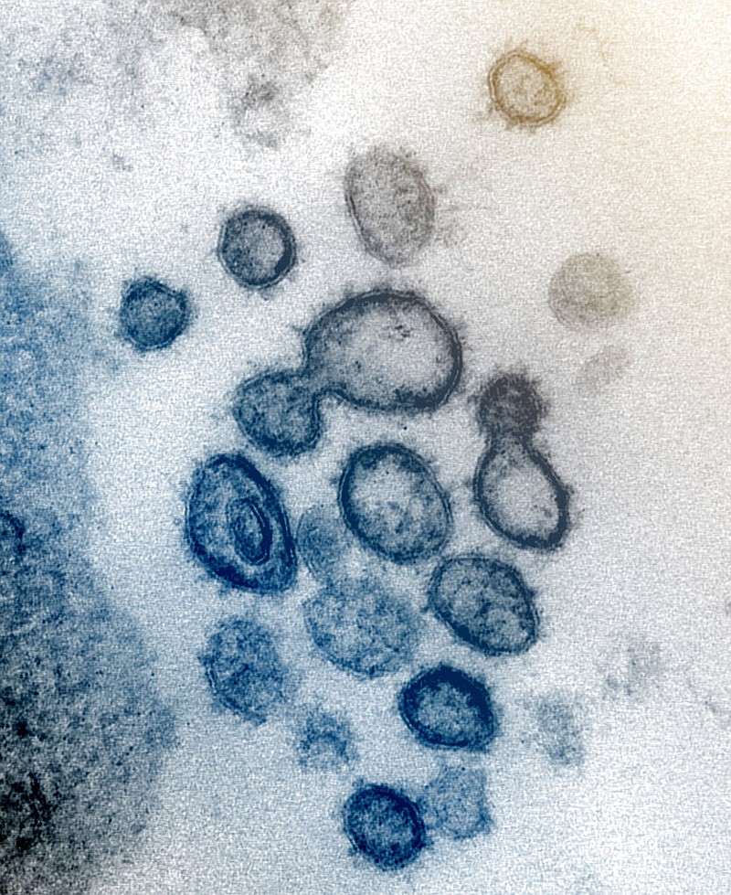 This undated electron microscope image made available by the U.S. National Institutes of Health in February 2020 shows the Novel Coronavirus SARS-CoV-2. Also known as 2019-nCoV, the virus causes COVID-19. The sample was isolated from a patient in the U.S.  (NIAID-RML via AP)