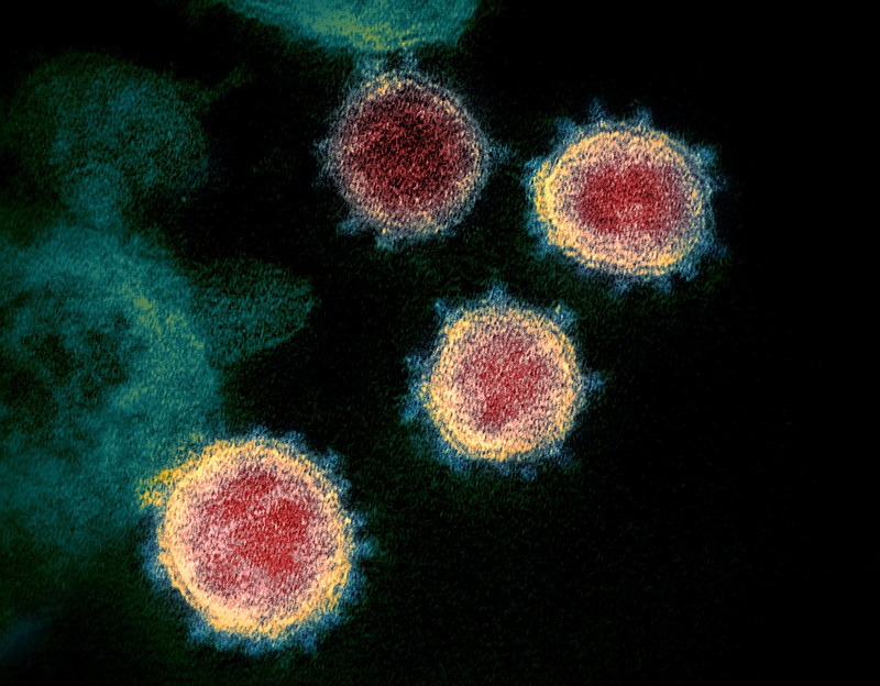 FILE - This undated electron microscope image made available by the U.S. National Institutes of Health in February 2020 shows the virus that causes COVID-19. The sample was isolated from a patient in the U.S.  (NIAID-RML via AP)