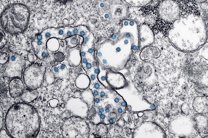 This 2020 electron microscope image made available by the U.S. Centers for Disease Control and Prevention shows the spherical particles of the new coronavirus, colorized blue, from the first U.S. case of COVID-19. Antibody blood tests for the coronavirus could play a key role in deciding whether millions of Americans can safely return to work and school. But public health officials warn that the current “Wild West” of unregulated tests is creating confusion that could ultimately slow the path to recovery. (Hannah A. Bullock, Azaibi Tamin/CDC via AP)