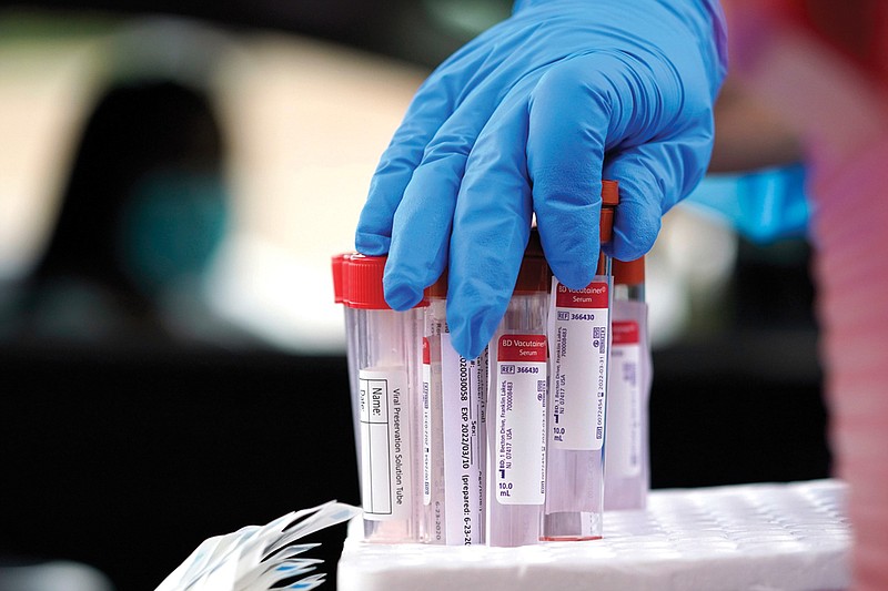 Healthcare professional Kenzie Anderson grabs a test tube for a sample at United Memorial Medical Center COVID-19 testing site Friday, June 26, 2020, in Houston. The number of COVID-19 cases continues to rise across the state. Texas Gov. Greg Abbott has said that the state is facing a "massive outbreak" in the coronavirus pandemic and that some new local restrictions may be needed to protect hospital space for new patients. (AP Photo/David J. Phillip)