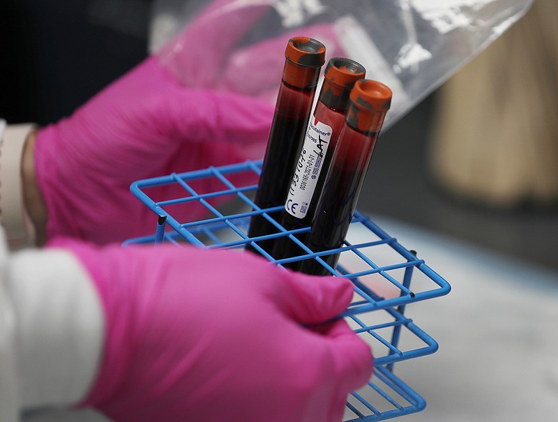 A patients blood samples are seen during a COVID-19 vaccination study at Research Centers of America on August 07, 2020 in Hollywood, Florida.  Research Centers of America is currently conducting COVID-19 vaccine trials, implemented under the federal government's Operation Warp Speed program. The center is recruiting volunteers to participate in the clinical trials, working with the Federal Government and major Pharmaceutical Companies, that are racing to develop a vaccine to potentially prevent COVID-19.  (Joe Raedle/Getty Images/TNS)