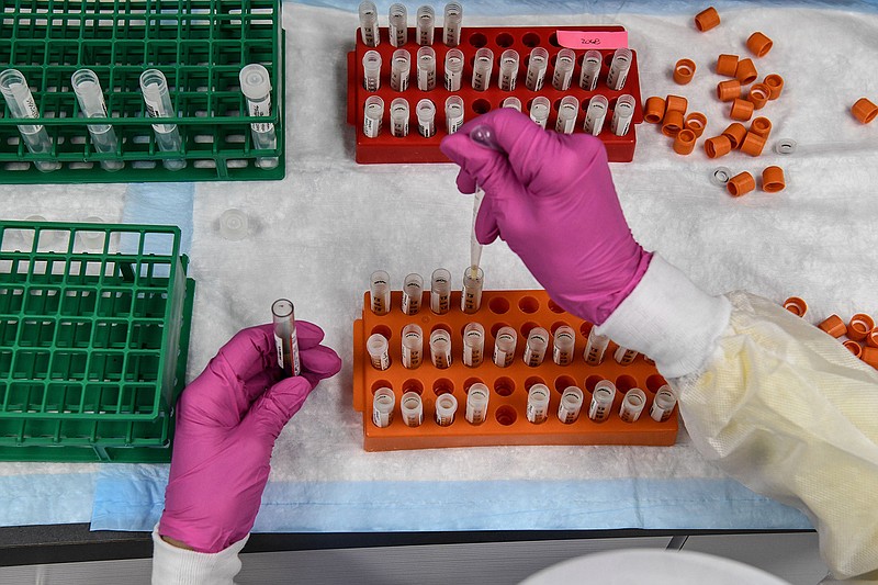 A lab technician sorts blood samples for COVID-19 vaccination study at the Research Centers of America in Hollywood, Florida on Aug. 13, 2020. (Chandan Khanna/AFP/Getty Images/TNS) 