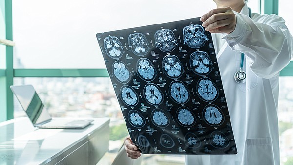 Dementia services difficult to come by for Georgians | Chattanooga Times Free Press - Vimarsana News