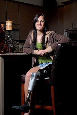 Woman trapped in car for week stands on a new prosthetic leg – The