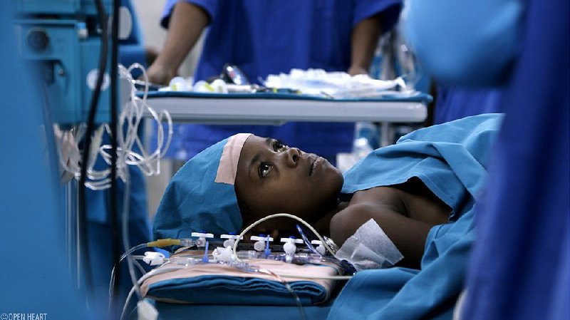 The Oscar-nominated documentary short Open Heart explores the state of cardiac surgery in Africa. 