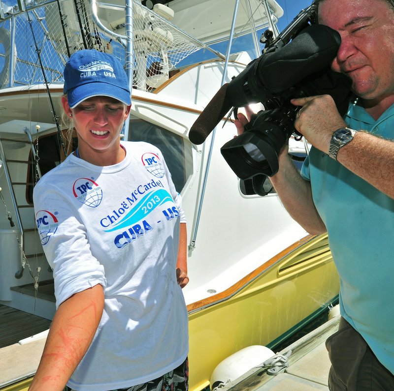 In this photo provided by the Florida Keys News Bureau, Australian endurance swimmer Chloe McCardel, left, shows painful jellyfish stings to Associated Press videographer Tony Winton Thursday, June 13, 2013, in Key West, Fla. McCardel was trying to become the first person to swim from Cuba to Florida without a shark cage. She was pulled from the water Wednesday, June 12, after being severely stung 11 hours into the swim that was expected to take about 60 hours.