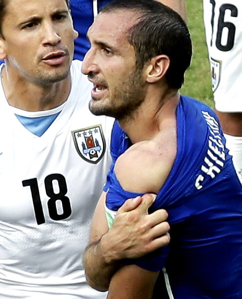 Italy’s Giorgio Chiellini displays his shoulder with apparent teeth marks after colliding with Uruguay’s Luis Suarez during Uruguay’s 1-0 victory in a World Cup Group D game in Natal, Brazil.