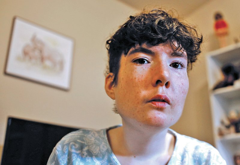 STAFF PHOTO DAVID GOTTSCHALK Mieke Bouwman, a 23-year-old woman with Prader-Willi syndrome, sits Tuesday in the living room of her Fayetteville apartment.