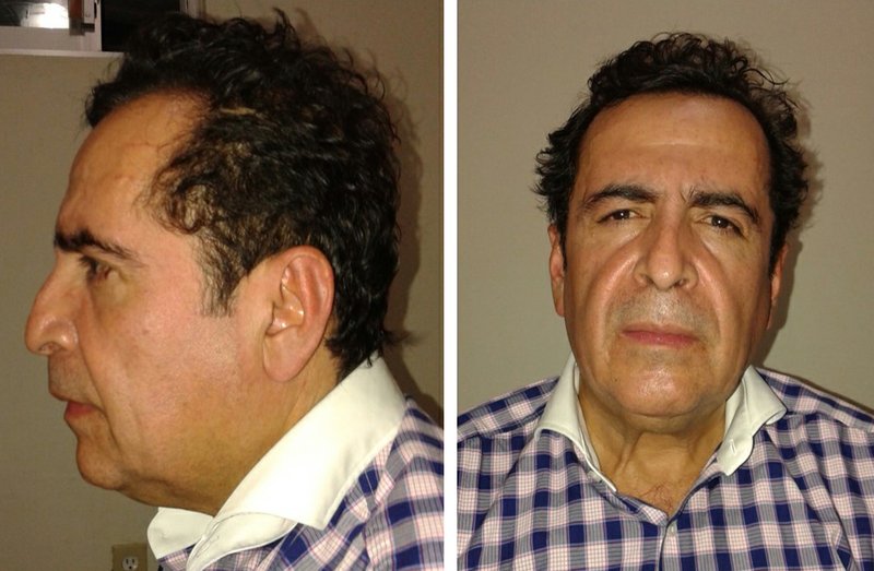 This two-image composite released by Mexico's Attorney General's Office (PGR) on Wednesday Oct. 1, 2014, shows alleged cartel capo Hector Beltran Leyva after his arrest by Mexican law enforcement authorities. The purported head of the Beltran Levya drug gang was captured in a seafood eatery in San Miguel de Allende, a city in the central state of Guanajuato that is a popular enclave for artists and foreigners. No shots were fired in the brief operation, which culminated an 11-month investigation, authorities said.