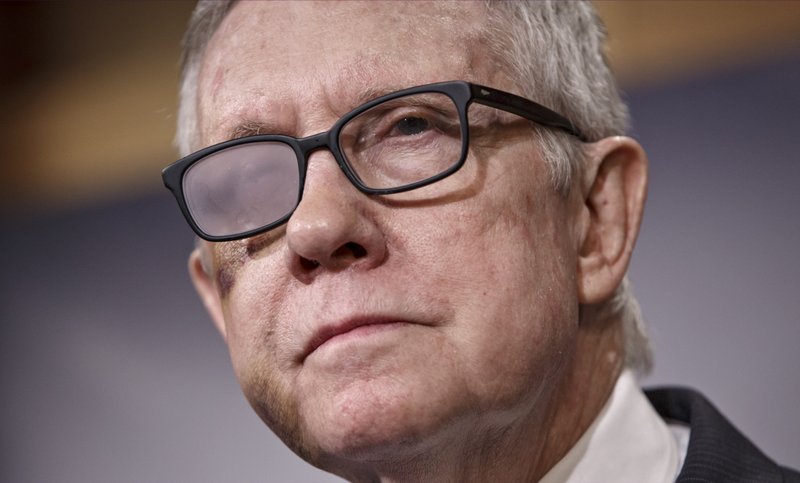 Senate Minority Leader Harry Reid of Nev. listens during a news conference on Capitol Hill in Washington, Thursday, Feb. 26, 2015, to talk about the impasse over advancing the Homeland Security budget because of Republican efforts to block President Barack Obama's executive actions on immigration. Reid is wearing special glasses as he recovers from injuries suffered in a violent exercise accident in December. 